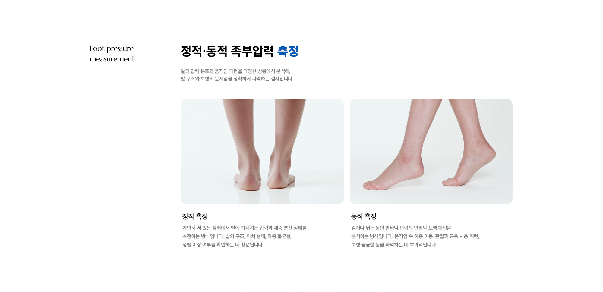[정적·동적 족부압력 측정] 발의 압력 분포와 움직임 패턴을 다양한 상황에서 분석해, 발 구조와 보행의 문제점을 정확하게 파악하는 검사입니다.