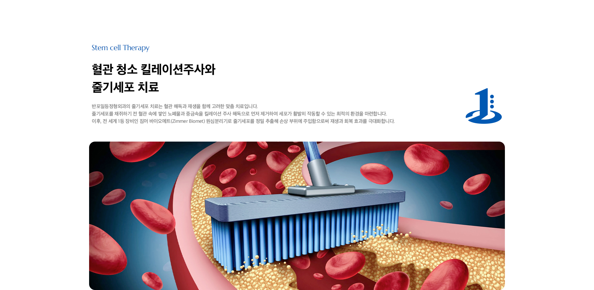 [혈관 청소 킬레이션주사와 줄기세포 치료] 반포일등정형외과의 줄기세포 치료는 혈관 해독과 재생을 함께 고려한 맞춤 치료입니다. 줄기세포를 채쥐하기 전 혈관 속에 쌓인 노폐물과 중금속을 킬레이션 주사 해독으로 먼저 제거하여 세포가 활발히 작동할 수 있는 최적의 환경을 마련합니다. 이후, 전 세계 1등 장비인 짐머 바이오메트(Zimmer Biomet) 원심분리기로 줄기세포를 정밀 추출해 손상 부위에 주입함으로써 재생과 회복 효과를 극대화합니다.